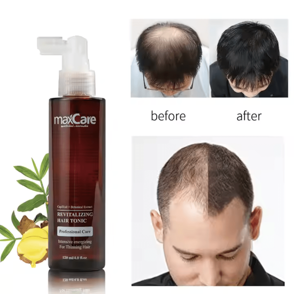 MaxCare - Revitalizing Hair Tonic - Hair Treatment - MaxCare Shop