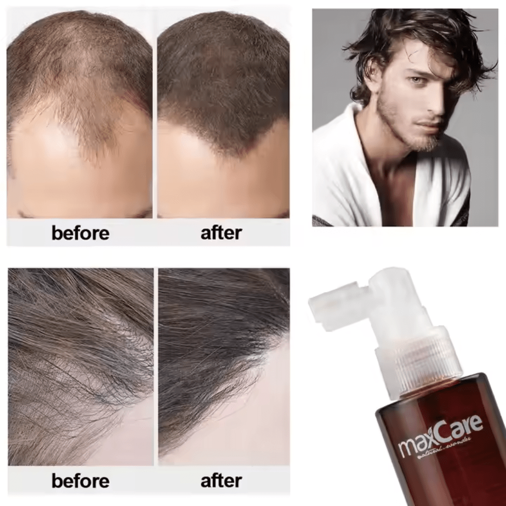 MaxCare - Revitalizing Hair Tonic - Hair Treatment - MaxCare Shop