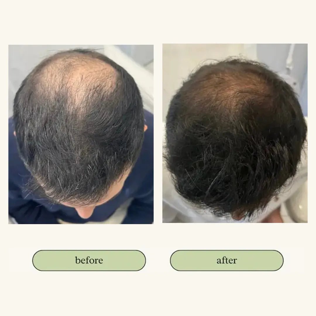 My Store - Vital Hair Trio Bundle - Hair Serum - MaxCare Shop