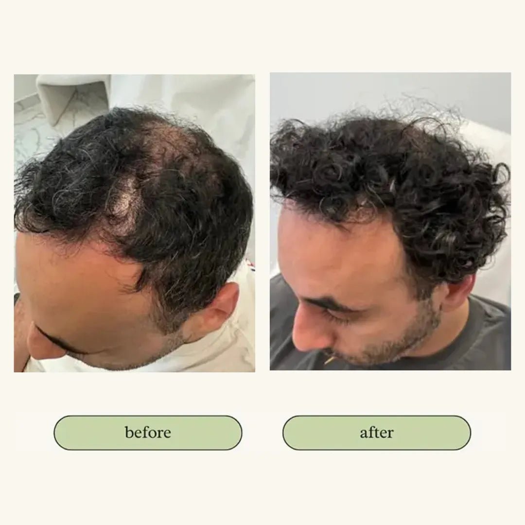 My Store - Vital Hair Trio Bundle - Hair Serum - MaxCare Shop