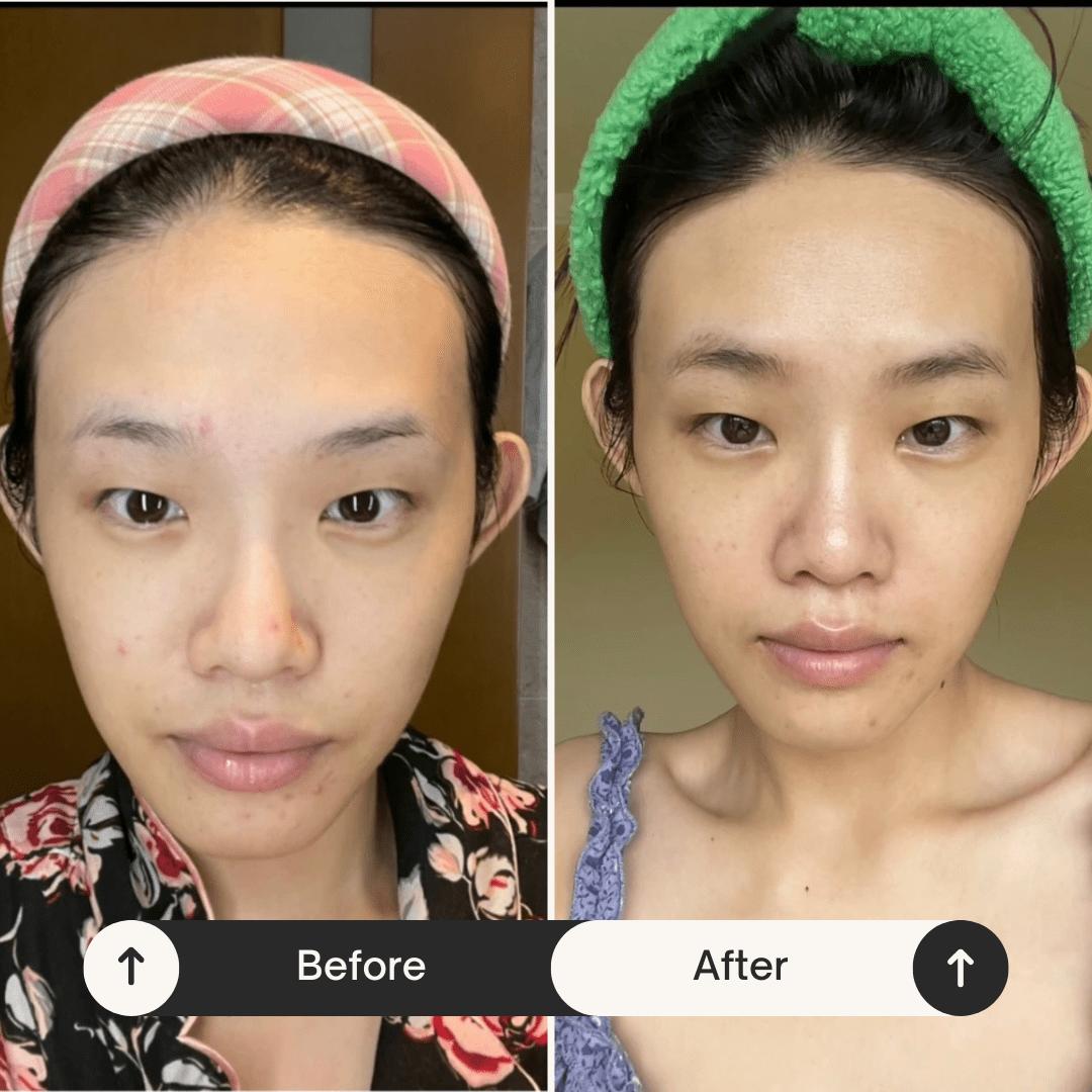 Nãzuk Beauty - Eyebrow Regrowth Mask - brow serum - MaxCare Shop